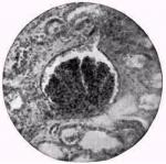 Figure 32. A glomerulus.