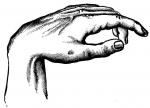 Figure 54. Wrist-drop due to paralysis